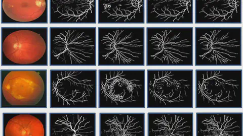 An innovate approach for retinal blood vessel segmentation using mixture of supervised and unsupervised methods